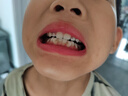 奧樂V6-12歲潔白系列小孩學(xué)生兒童護(hù)牙劑 換牙期蟲牙牙黃黑斑 兒童牙膏 【專業(yè)潔白】50克1支裝，送4件禮 曬單實(shí)拍圖