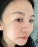 仟林語臉部激光點(diǎn)痣后去紅印黑印去凹陷疤痕修復(fù)液凝膠生長因子除疤膏YZ 兩盒裝 第二盒半價(jià)【基礎(chǔ)裝】 曬單實(shí)拍圖