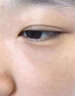 汗管瘤眼部去除油脂粒祛眼部周圍脂肪粒專用眼霜眼油脂粒涂抹藥膏 單盒裝 曬單實拍圖