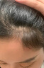 同仁堂【發(fā)量翻倍漲】育發(fā)液防脫發(fā)育發(fā)濃密增長(cháng)液頭發(fā)生長(cháng)激活毛囊增發(fā) 買(mǎi)2送1【針對中度脫發(fā)】增發(fā)密發(fā) 曬單實(shí)拍圖