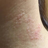 百草止癢膏抑全身皮膚瘙癢真菌感染肛周瘙癢肛門潮濕疹男性陰囊瘙癢女私處瘙癢止癢瘙癢止癢非藥正品外用膏 1支裝【20g】瘙癢、潮濕、滲液 曬單實拍圖