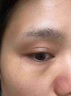 脂肪粒去除藥膏神器眼部專用眼霜消除汗管瘤脂肪油脂粒粟丘疹克星 特效:一盒裝 曬單實(shí)拍圖