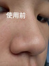 fUT去黑頭導(dǎo)出液收縮毛孔精華免撕拉深層清潔粉刺閉口毛孔粗大男女士 去黑頭縮毛孔組合乳糖酸精華42ml 曬單實拍圖