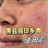BUV美白洗面奶氨基酸祛斑痘印煙酰胺提亮水楊酸控油變白男女法國(guó)進(jìn)口 曬單實(shí)拍圖