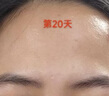 康佳膠原炮美容儀器家用臉部眼部按摩提拉儀緊致面部紅光子嫩膚導(dǎo)入按摩儀七夕情人節(jié)禮物送女友 二代膠原炮pro-雙頻微電流提拉+滲透導(dǎo)入+磁吸蓋 曬單實拍圖