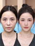 OHBT祛痘膏60g青春痘閉孔粉刺收縮毛孔專用學(xué)生男女凝膠男士化妝品 曬單實拍圖