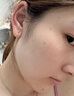 武田大?！救毡綯akada】去痣點(diǎn)痣膏疤痕修復(fù)專用點(diǎn)疣祛斑點(diǎn)斑藥水修復(fù)液 1~3顆黑痣【1盒 5ml+5g修復(fù)膏】 曬單實(shí)拍圖