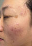 巖井昃弘去斑專用醫(yī)用正品祛斑霜美白淡化黃褐雀斑黑色素老年點斑藥一夜消 特價產(chǎn)品【藥效不足】不退不換 美白祛斑霜 曬單實拍圖