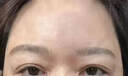 秋雅奈緒川字紋貼去除神器男女士去抬頭紋法令紋懸紋睡覺(jué)填充除皺紋專用 買(mǎi)2送1【99%顧客選擇】一抹消紋 曬單實(shí)拍圖