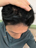 艾爾莎米諾地爾酊紅光生發(fā)梳頭皮上藥器電動生發(fā)液按摩儀家用頭部增發(fā)密發(fā)神器頭發(fā)養(yǎng)發(fā)健發(fā)梳導(dǎo)液上液器梳子 海鮮藍【紅光養(yǎng)護-發(fā)根鞏固】生發(fā)梳DYS-15 不卡發(fā)/不漏液/無線便捷/保密發(fā)貨 曬單實拍圖