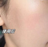 韓方五谷壬二酸祛痘藥膏去痘痘和淡化痘印精華液護膚品青春痘男女學(xué)生 曬單實拍圖