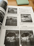 乳腺影像診斷學(xué) 上?？茖W(xué)技術(shù)出版社 彭衛軍 等 編 書(shū)籍 圖書(shū) 曬單實(shí)拍圖