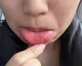 蓬仁藥業(yè)口腔潰瘍修復(fù)凝膠口腔潰瘍專用的藥口舌生瘡上火兒童可搭口腔潰瘍貼可搭口腔潰瘍散西瓜霜口腔潰瘍噴劑一點(diǎn)靈 曬單實(shí)拍圖