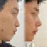 慕心姿坊 BEAUTY ADMIRE鼻梁增高瘦鼻子變高變挺增高塌挺鼻美鼻神器翹瘦鼻頭縮小鼻翼精油 鼻部塑顏精華液【一瓶裝】 曬單實(shí)拍圖
