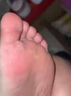 達克寧腳氣藥止癢脫皮爛腳丫真菌感染治腳氣皮膚用藥 非處方藥爛腳丫的特藥腳爛腳趾縫潰爛癢硝酸咪康唑乳膏 3盒【長期反復(fù)嚴(yán)重腳氣 爛癢臭】療程裝 達克寧腳氣藥止癢脫皮爛腳丫真菌感染治腳氣 曬單實拍圖