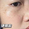 OHBT377美白祛斑面霜50g女男士保濕去黃淡化黑色素黃褐斑雀斑護(hù)膚品 曬單實(shí)拍圖