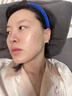 維特絲祛痘藥膏50g壬二酸水楊酸去痘痘和收毛孔閉口粉刺男女精華 曬單實拍圖