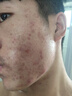 LANLVX英國氨基酸洗面奶控油除螨祛痘毛孔清潔男女士潔面乳高端護理品牌 控油除螨1支（150ml） 曬單實拍圖