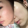 維邦樂醫(yī)用冷敷貼面膜械字號補水皮膚屏障修復醫(yī)美重組膠原蛋白敷料3盒 曬單實拍圖