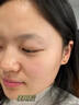 南京同仁堂祛痘膏去痘痘和痘印痘坑修復(fù)男女士改善粉刺閉口30g 曬單實拍圖