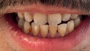 高露潔（Colgate）【孫穎莎同款】速感白美白牙膏亮白去黃去煙漬85g 新老包裝隨機 曬單實拍圖