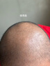 蔓迪生發(fā)噴霧米諾地爾酊90ml瓶5%濃度男女性防脫育發(fā)液藥洗發(fā)水發(fā)際線生長快速生發(fā)增發(fā)凝膠搽劑曼迪 曬單實(shí)拍圖