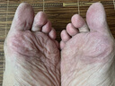 BEAI皸裂腳裂膏腳后跟防干裂皸裂龜裂開(kāi)裂凍裂膏護(hù)手足干裂潤(rùn)膚霜 曬單實(shí)拍圖