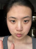 南京同仁堂祛痘膏去痘痘和痘印痘坑修復(fù)男女士改善粉刺閉口30g 曬單實拍圖
