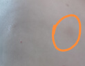 御傳堂牛皮癬專用頑固銀屑病皮膚瘙癢真菌止癢抑菌膏 御夫靈1盒 曬單實(shí)拍圖