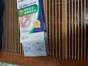 赤坂制薬甲溝炎矯正器嵌甲貼片足部固定器腳指糾正甲貼趾甲紅腫肉芽 曬單實拍圖