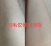 奧克斯（AUX）【國家補貼】冰點脫毛儀藍寶石全身腋下私處家用剃毛器 男士老婆節(jié)日禮盒裝 1127ProMax大能量19J 曬單實拍圖