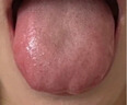脾胃虛弱濕氣重肝火盛氣血不足 調(diào)理脾胃的中成藥脾胃虛弱中藥調(diào)理去濕氣調(diào)理脾胃參苓健脾胃顆粒脾胃調(diào)理 1盒裝【補(bǔ)脾健胃】5天用量 曬單實(shí)拍圖