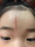 邦孚手祛疤痕專用修復(fù)去疤痕修復(fù)凝膠除疤膏疤痕增生凸起去除疙瘩祛疤膏 曬單實(shí)拍圖