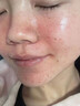 奈皙日本曬后修復(fù)急救皮膚屏障受損泛紅積雪草曬傷藥膏男士醫(yī)美用煥白 曬單實(shí)拍圖