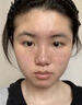 巖井昃弘祛斑點斑專用水藥去斑霜強效第1名臉部手背醫(yī)用正品老年斑曬斑女 買2發(fā)3【500%包裉除】日本進口 美白淡化黃褐雀斑黑色素男女士 曬單實拍圖