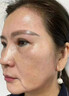 片仔癀皇后牌美白祛斑膏美白淡化黑色素老年黃褐雀斑曬斑祛斑霜護(hù)膚品女 美白祛斑膏1瓶【贈防曬霜】 曬單實拍圖