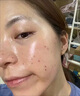 Newliann醫用重組三型人源化膠原蛋白外用人表皮生長(cháng)因子凝膠皮膚疤痕修復 曬單實(shí)拍圖