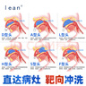 lean樂(lè )恩鼻哈哈洗鼻器噴頭配件 適用于水動(dòng)能可調式鼻腔清洗器手動(dòng)款 F型噴頭（鼻咽放療后沖洗）*1 曬單實(shí)拍圖