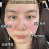 奈皙日本曬后修復(fù)面膜急救敏感泛紅女男士夏季神經(jīng)酰胺改善醫(yī)美用煥白 曬單實(shí)拍圖