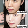 膚草集蝦青素面膜美白補水保濕淡斑抗皺緊致抗老去黃提亮男女專(zhuān)用護膚品 曬單實(shí)拍圖