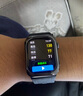 VTT WATCH ID2華為機鴻蒙系統蘋(píng)果機iOS適用智能測血糖血壓監測手表男女血脂尿酸心率睡眠官方旗艦店 WITCH ID2【醫用氣囊款】血糖血壓尿酸血脂監測 曬單實(shí)拍圖