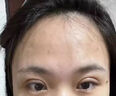 藤石制藥醫用雙眼皮手術(shù)術(shù)后熱敷眼罩可搭冰敷消腫蒸汽眼罩熱敷水腫神器MW 5盒長(cháng)效裝【買(mǎi)3送2】疤痕體質(zhì)擔心留疤長(cháng)效貼敷 曬單實(shí)拍圖