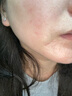 華美科 HURMEVKOR熊果苷乳膏退黑色素?zé)燉０纺z復(fù)方熊果苷軟膏熊果苷乳霜補(bǔ)水1支 曬單實(shí)拍圖