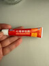福元紅霉素軟膏抗菌感染消炎消腫止癢私處男士皮膚感染真菌抗真菌痔瘡膿包女士私處止癢外陰用正品軟膏 2盒 【抗菌消炎止癢】 紅霉素軟膏外用 曬單實(shí)拍圖