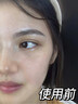 郝愛妮美白祛斑霜淡化黑色素去雀斑黃褐斑祛斑美白提亮去黃改善暗沉膚色 曬單實(shí)拍圖