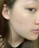 維特絲祛痘藥膏50g壬二酸水楊酸去痘痘和收毛孔閉口粉刺男女精華 曬單實(shí)拍圖