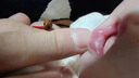 德國Mykoderm嬰幼兒童鵝口瘡凝膠咪康唑口腔潰瘍凝膠嬰兒鵝口瘡用藥 德國原裝進(jìn)口 鵝口瘡凝膠20g/支 曬單實(shí)拍圖