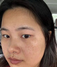 YYTISS377祛斑美白淡斑淡化黑色素藥霜黃褐斑雀斑曬斑女煙酰胺男士專(zhuān)用 曬單實(shí)拍圖