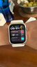 華為（HUAWEI）WATCH D2 晨曦金 華為智能手表動(dòng)態(tài)血壓監(jiān)測(cè)一鍵微體檢再升級(jí)多種健康研究輕巧時(shí)尚華為新款血壓表 曬單實(shí)拍圖