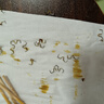 海沃希皮膚拆釘器醫(yī)用取釘器包皮鈦釘取釘器手術(shù)后拆線鉗無菌外科撥釘器 【醫(yī)用備案產(chǎn)品】皮膚取釘器 曬單實拍圖